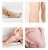 Medical Compression Socks Unisex Varicose Veins Socks Elastic Pressure Stockings Sleep Feet Varicose Vein Treatment 1pair