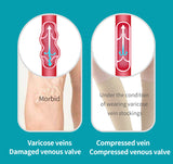 Medical Compression Socks Unisex Varicose Veins Socks Elastic Pressure Stockings Sleep Feet Varicose Vein Treatment 1pair
